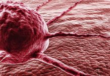 Вчені навчилися передбачати рак за десять років до початку захворювання