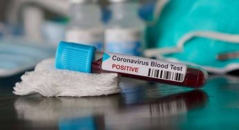 Лікар назвав методи які допоможуть захиститися від коронавірусу