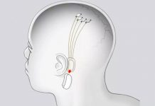 Ілон Маск пообіцяв протягом року почати експерименти з імплантації чіпів в мозок людей